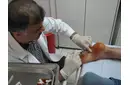 Topuk Dikeni Ameliyatı Nedir ve Nasıl Yapılır?